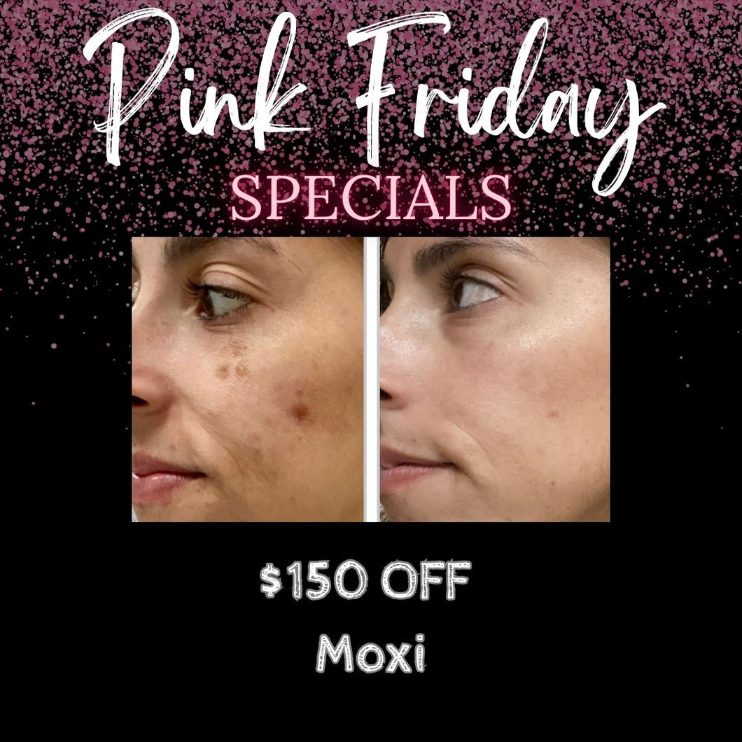 $150 OFF Moxi Face & Neck