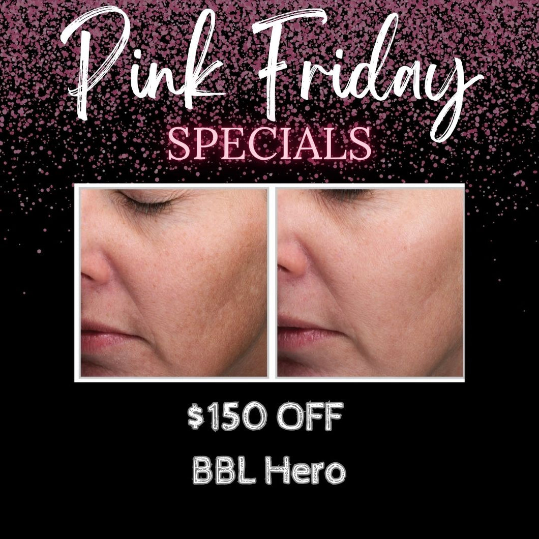 $150 OFF BBL Hero Face & Neck